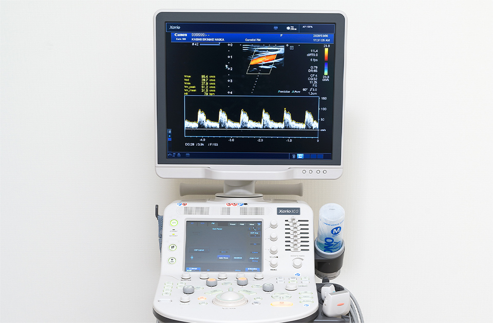 超音波診断装置（エコー）